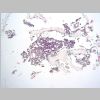 Medula osea HE 01.jpg
